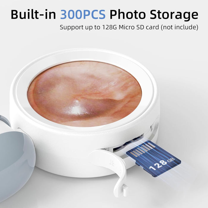 Smart Ear Scope – Ear Camera with Built-In Screen